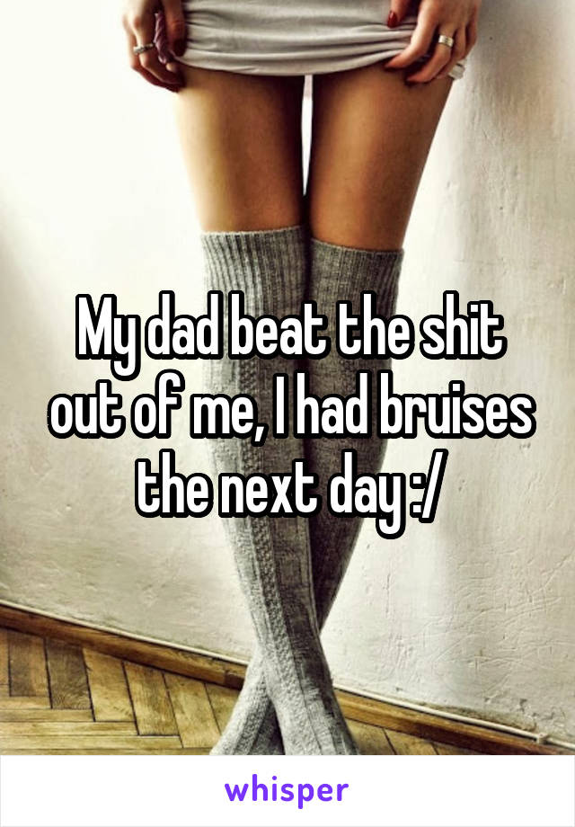 My dad beat the shit out of me, I had bruises the next day :/