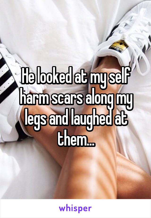 He looked at my self harm scars along my legs and laughed at them...