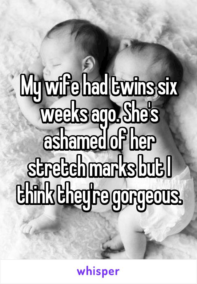 My wife had twins six weeks ago. She's ashamed of her stretch marks but I think they're gorgeous.