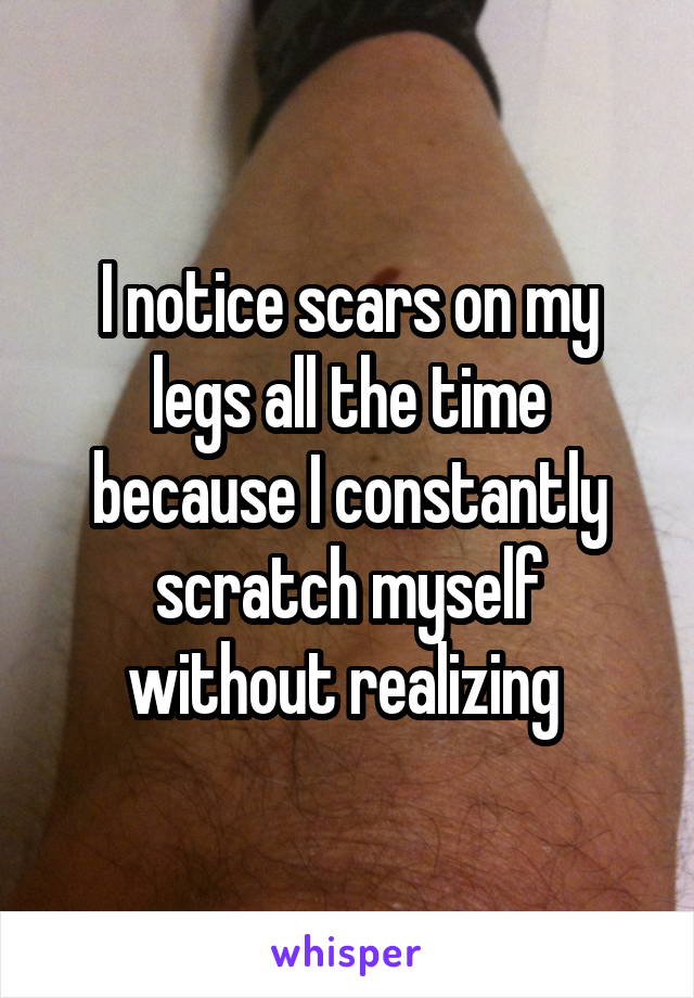 I notice scars on my legs all the time because I constantly scratch myself without realizing 