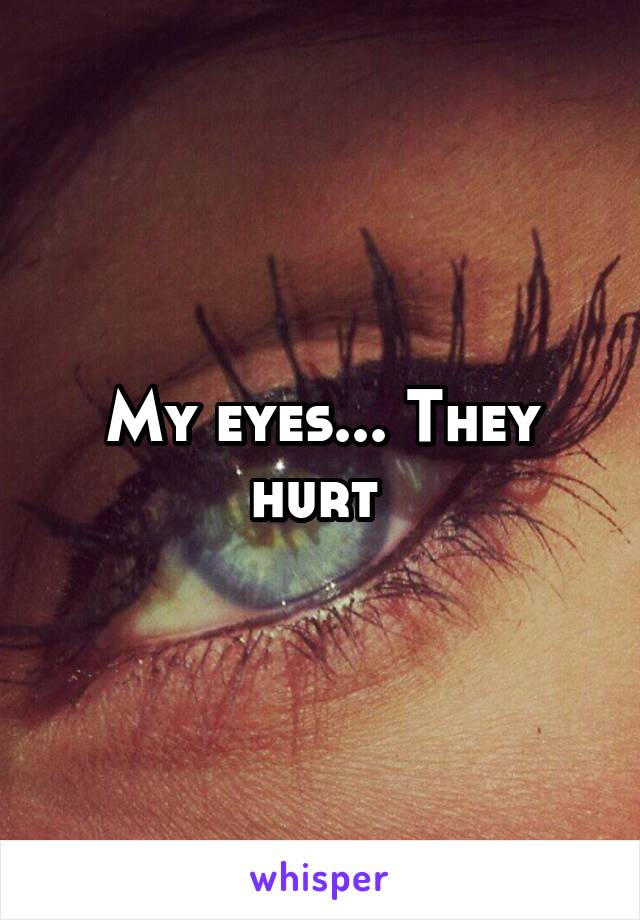 My eyes... They hurt 