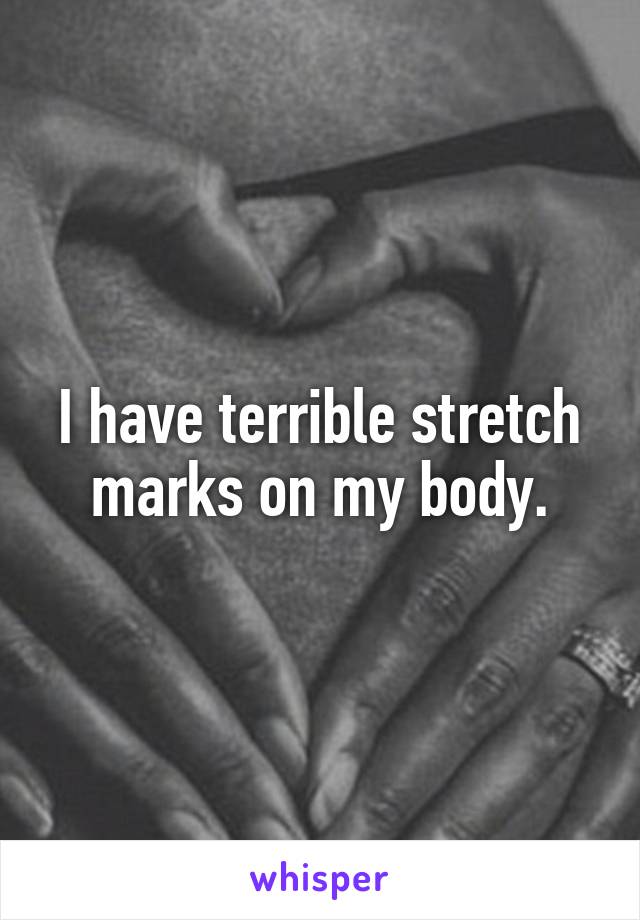 I have terrible stretch marks on my body.