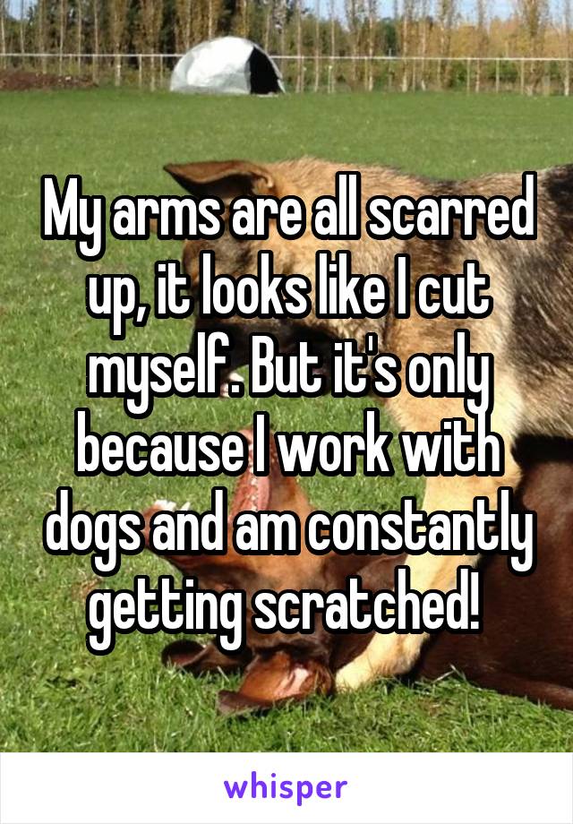 My arms are all scarred up, it looks like I cut myself. But it's only because I work with dogs and am constantly getting scratched! 