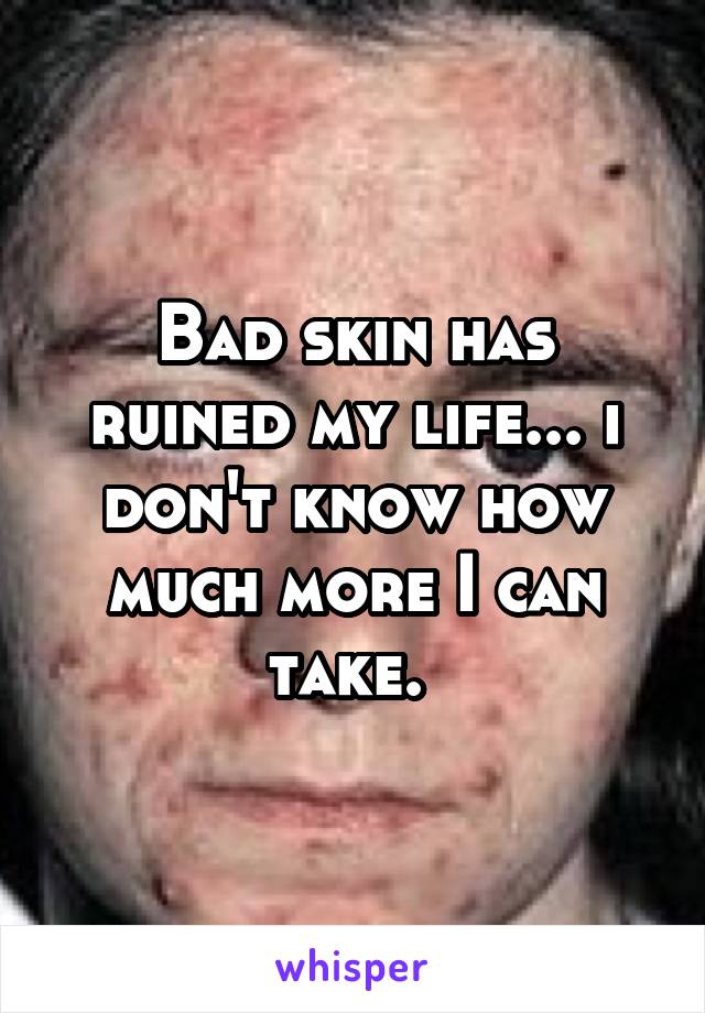 Bad skin has ruined my life... i don't know how much more I can take. 