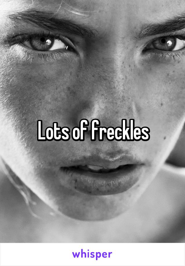 Lots of freckles