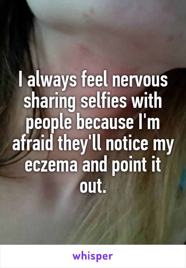 I always feel nervous sharing selfies with people because I'm afraid they'll notice my eczema and point it out.