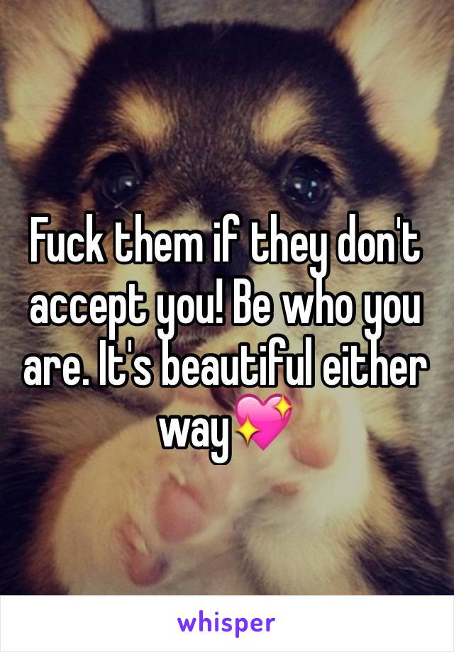 Fuck them if they don't accept you! Be who you are. It's beautiful either way💖