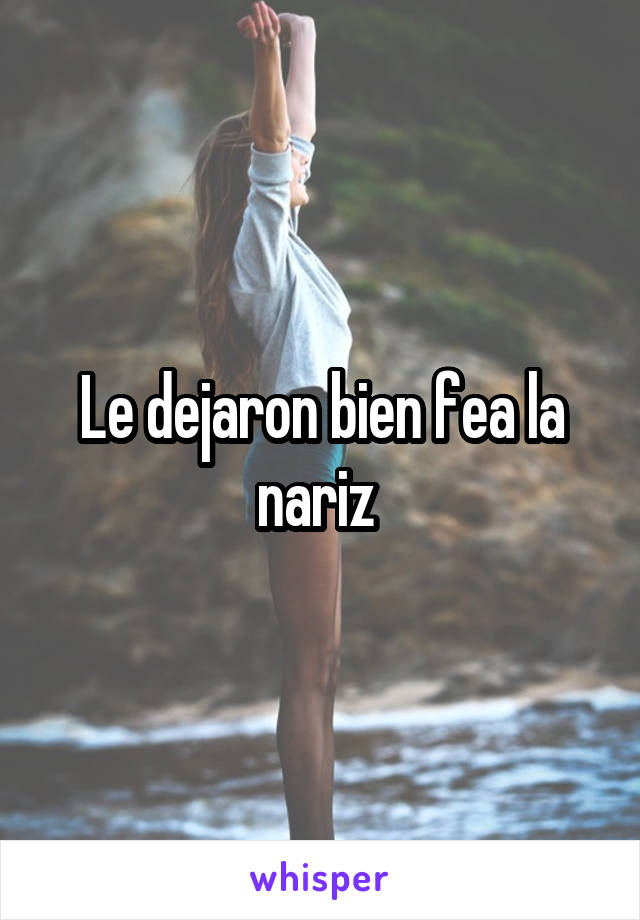 Le dejaron bien fea la nariz 