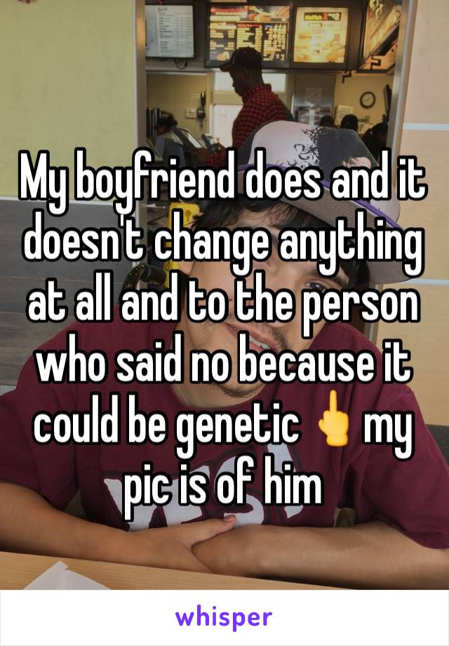 My boyfriend does and it doesn't change anything at all and to the person who said no because it could be genetic🖕my pic is of him 