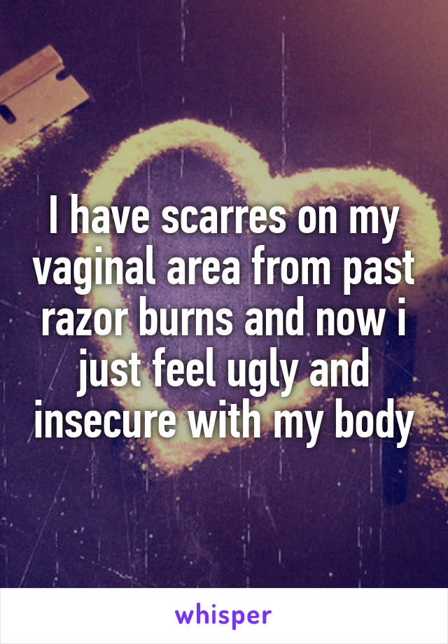 I have scarres on my vaginal area from past razor burns and now i just feel ugly and insecure with my body