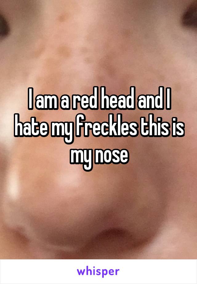 I am a red head and I hate my freckles this is my nose
