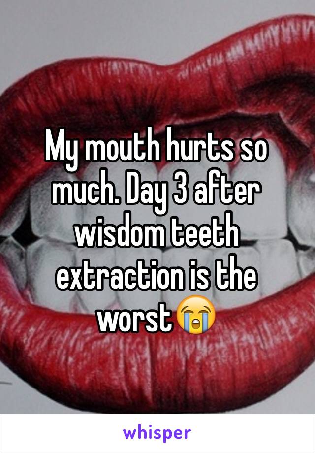My mouth hurts so much. Day 3 after wisdom teeth extraction is the worst😭