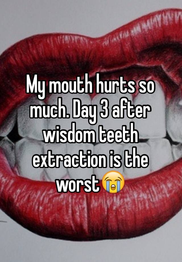 my-mouth-hurts-so-much-day-3-after-wisdom-teeth-extraction-is-the-worst