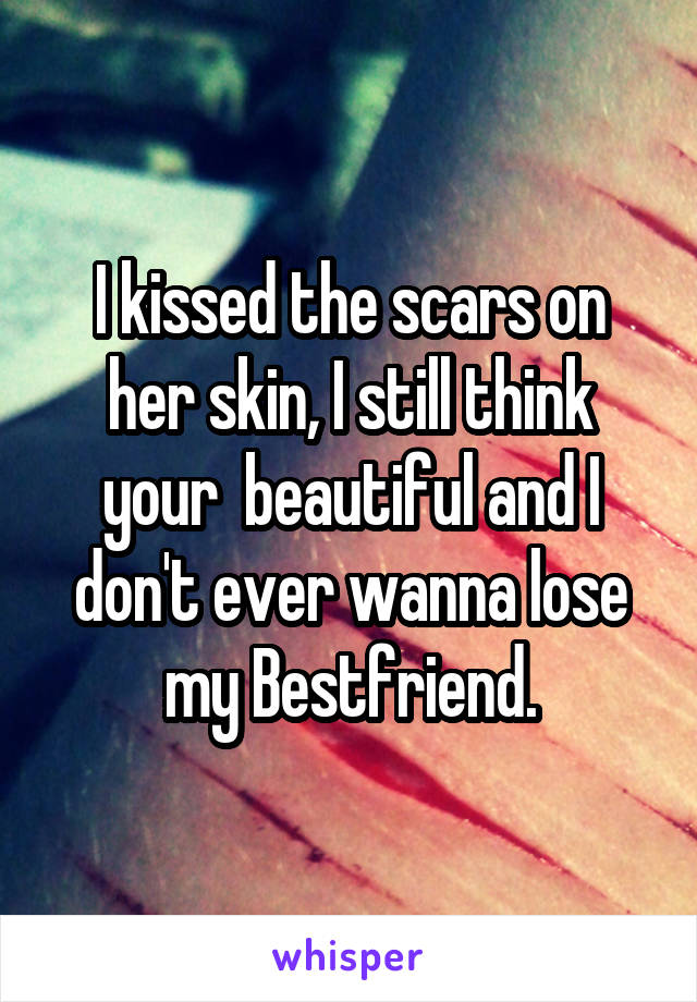 I kissed the scars on her skin, I still think your  beautiful and I don't ever wanna lose my Bestfriend.