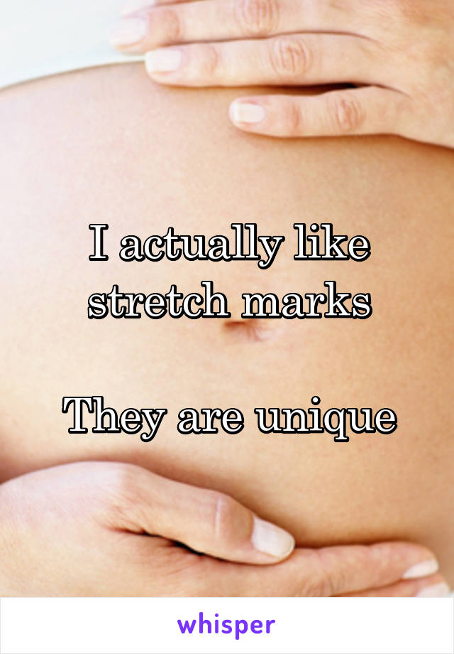 I actually like stretch marks

They are unique