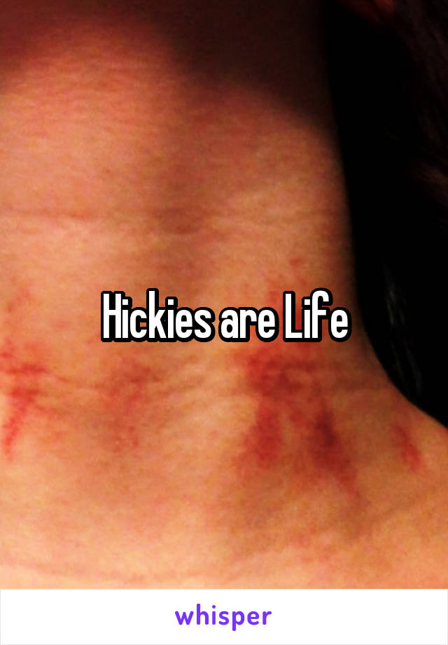 Hickies are Life