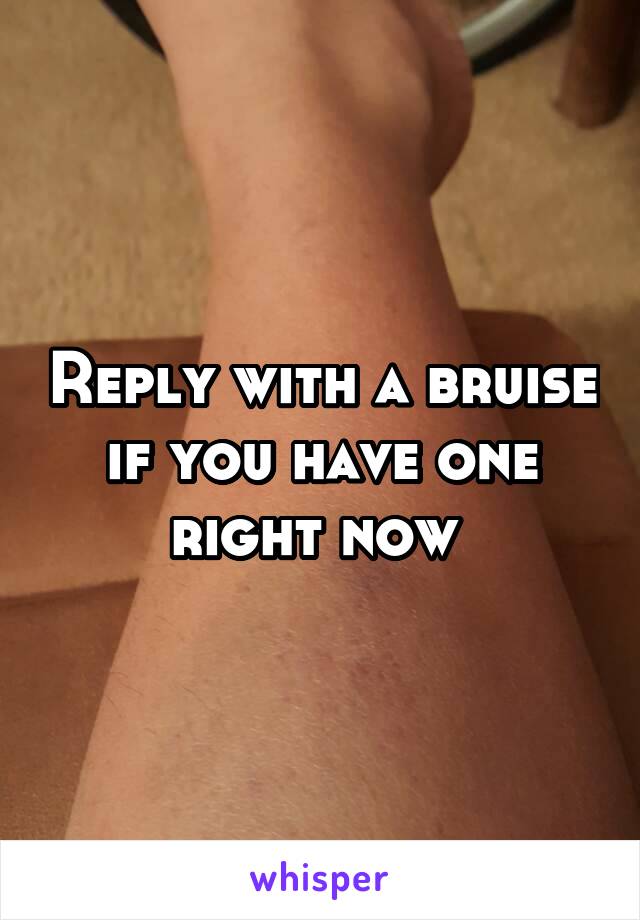 Reply with a bruise if you have one right now 