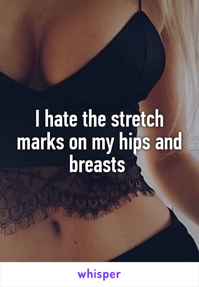 I hate the stretch marks on my hips and breasts 