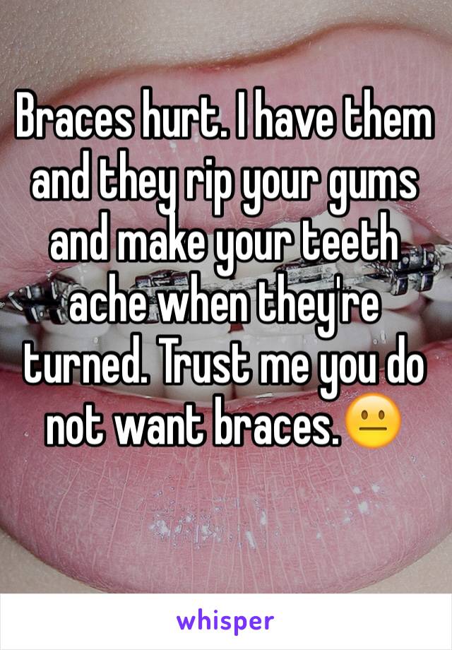 Braces hurt. I have them and they rip your gums and make your teeth ache when they're turned. Trust me you do not want braces.😐
