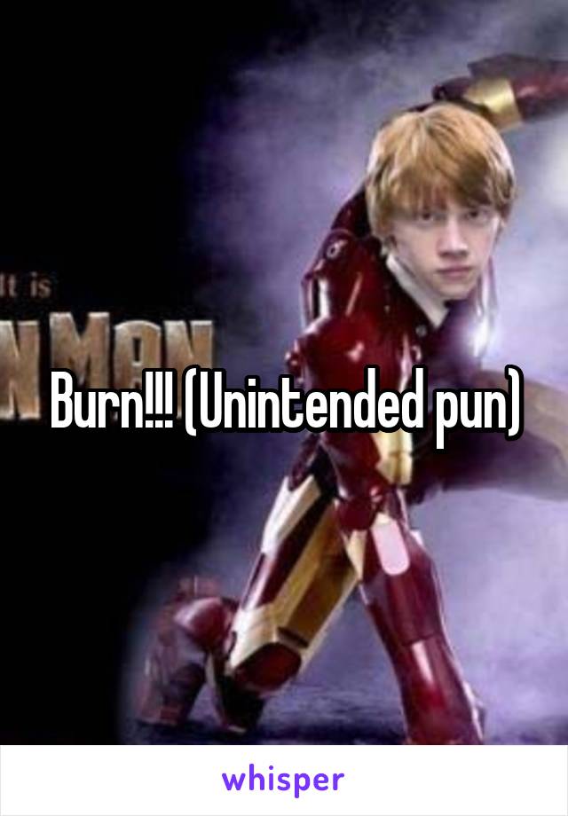 Burn!!! (Unintended pun)