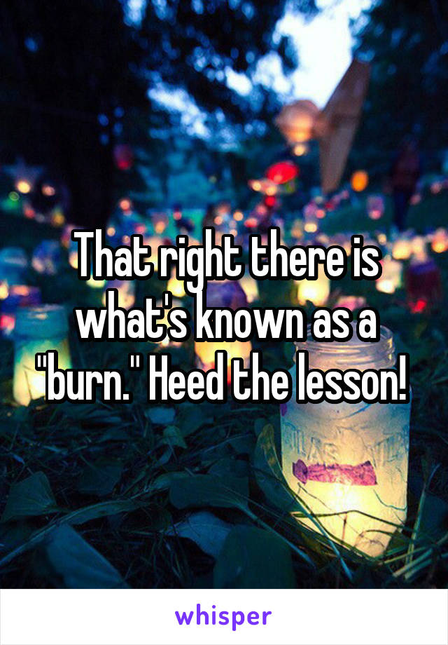 That right there is what's known as a "burn." Heed the lesson! 