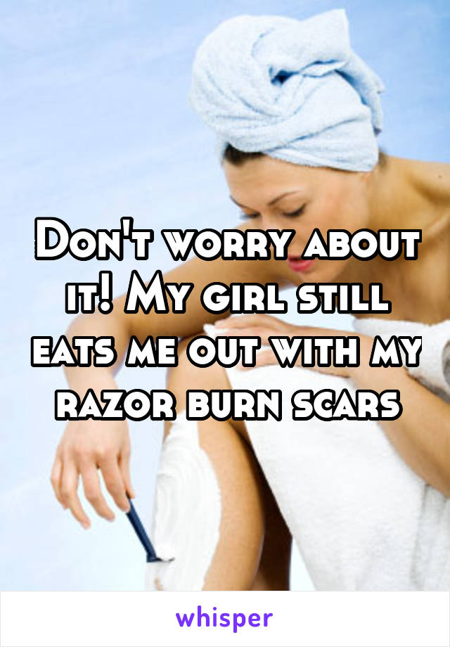 Don't worry about it! My girl still eats me out with my razor burn scars