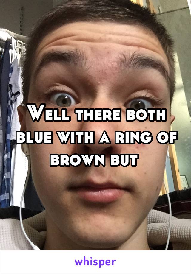 Well there both blue with a ring of brown but 