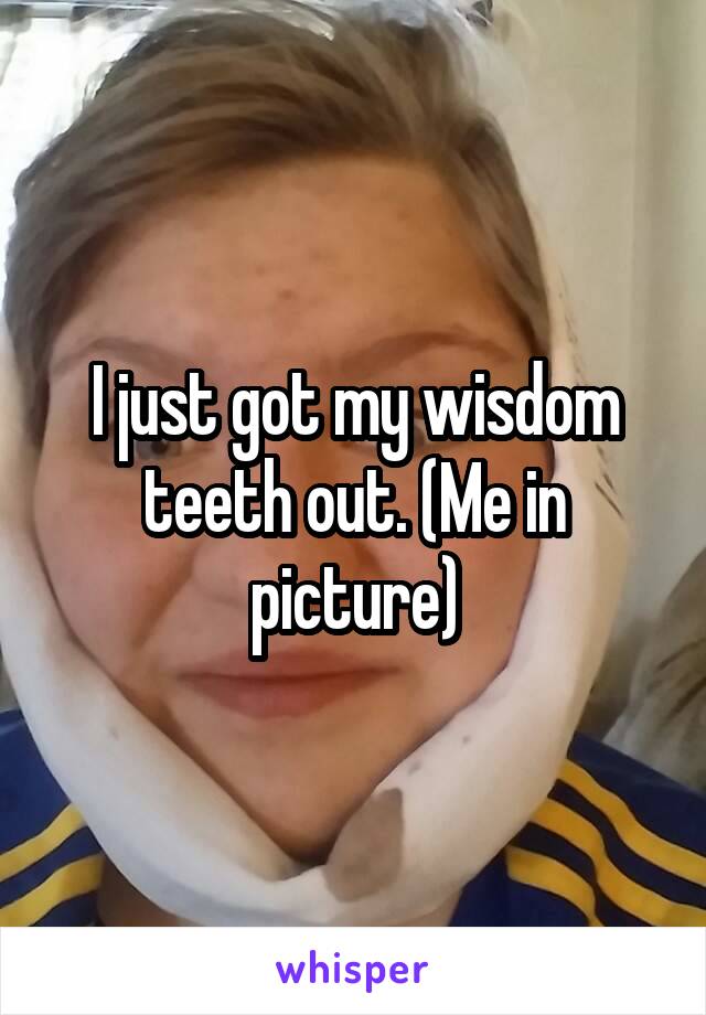 I just got my wisdom teeth out. (Me in picture)