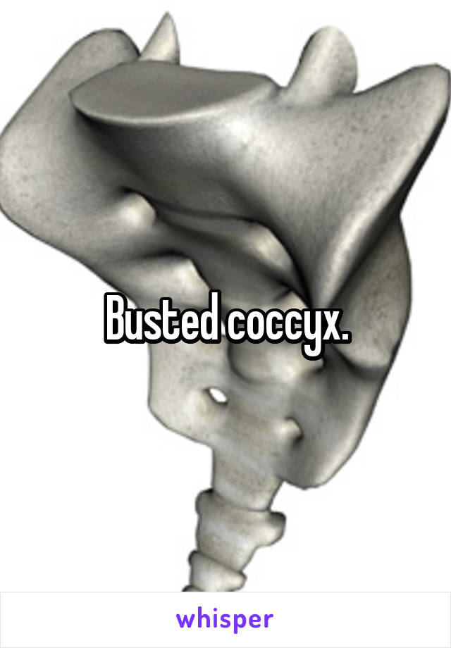 Busted coccyx.