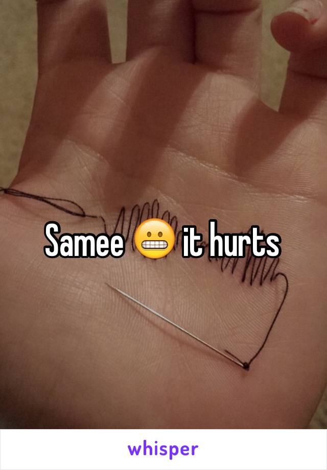 Samee 😬 it hurts