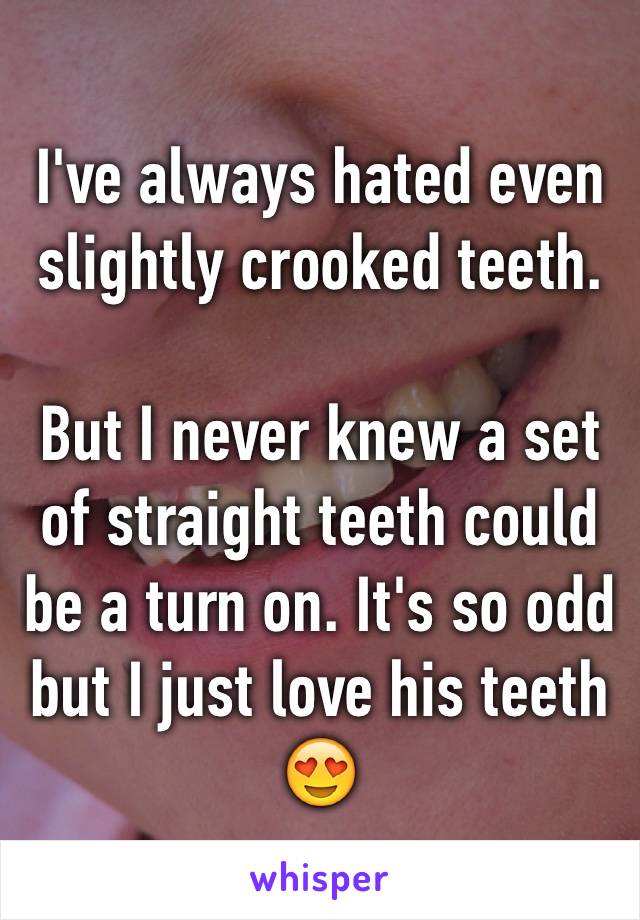 I've always hated even slightly crooked teeth.

But I never knew a set of straight teeth could be a turn on. It's so odd but I just love his teeth 😍