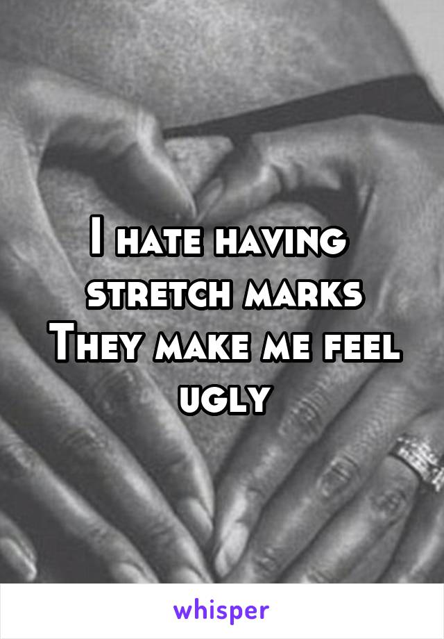 I hate having 
stretch marks
They make me feel ugly