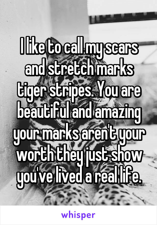 I like to call my scars and stretch marks tiger stripes. You are beautiful and amazing your marks aren't your worth they just show you've lived a real life.
