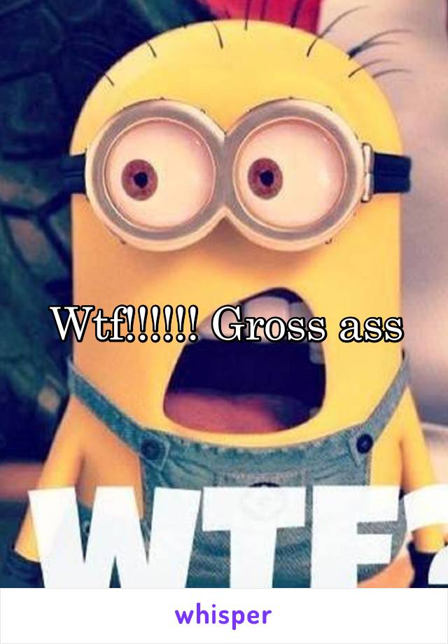 Wtf!!!!!! Gross ass