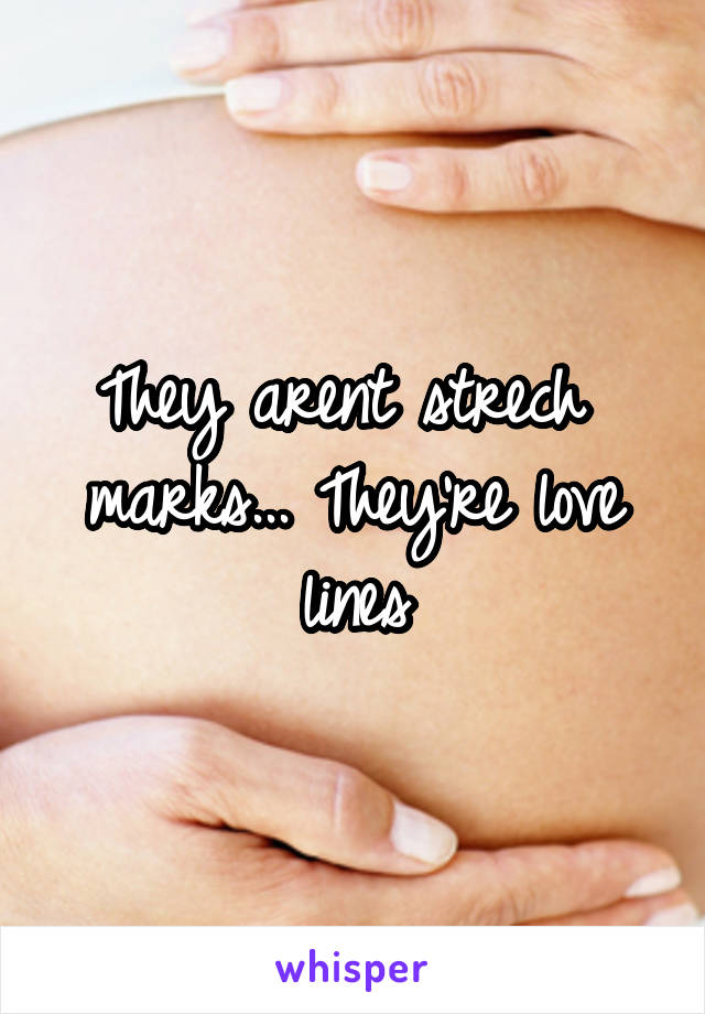 They arent strech  marks... They're love lines