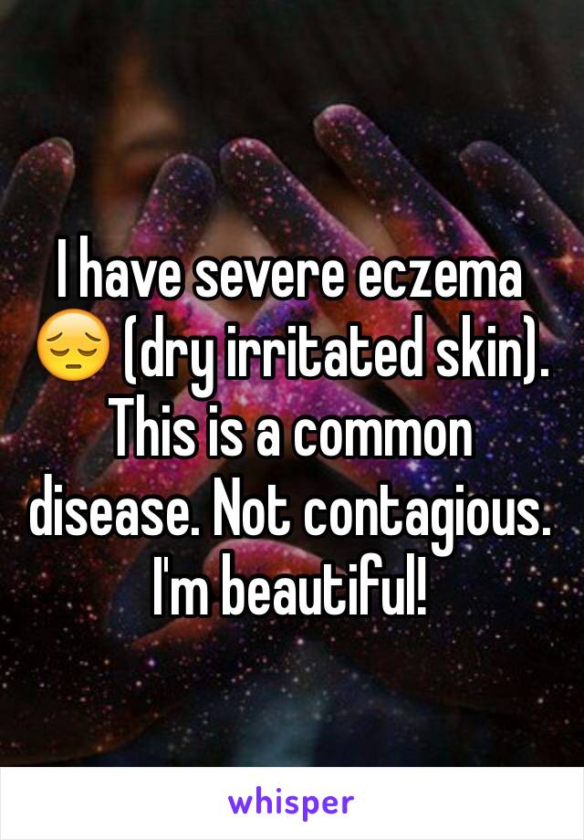 I have severe eczema 😔 (dry irritated skin).  This is a common disease. Not contagious. I'm beautiful! 