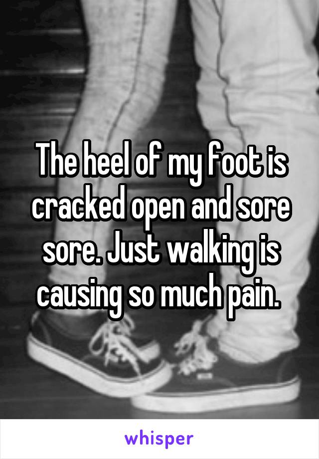 The heel of my foot is cracked open and sore sore. Just walking is causing so much pain. 