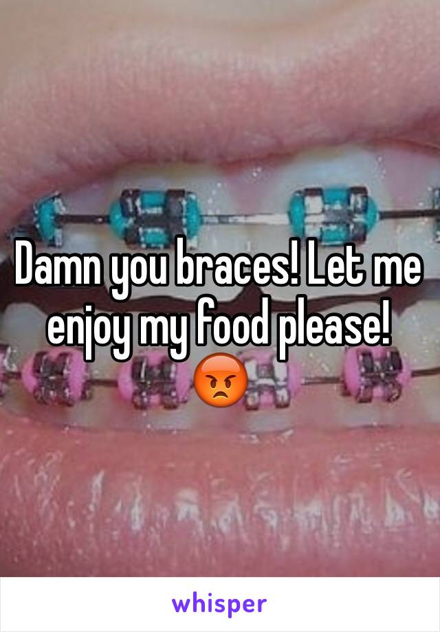 Damn you braces! Let me enjoy my food please! 😡