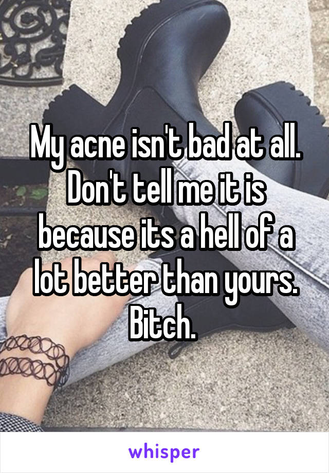 My acne isn't bad at all. Don't tell me it is because its a hell of a lot better than yours. Bitch. 