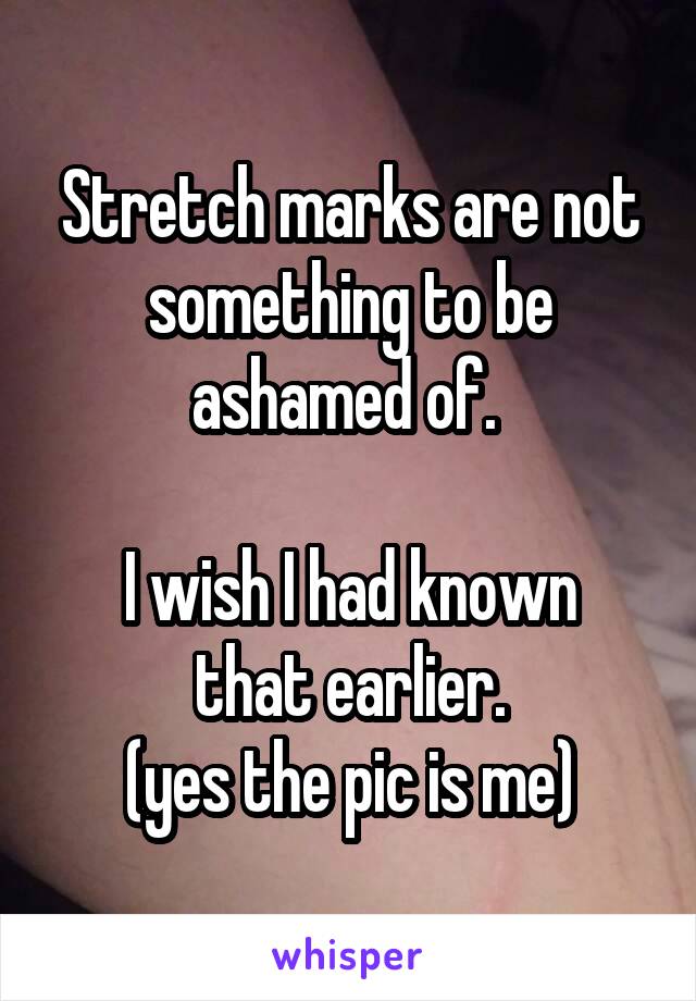 Stretch marks are not something to be ashamed of. 

I wish I had known that earlier.
(yes the pic is me)