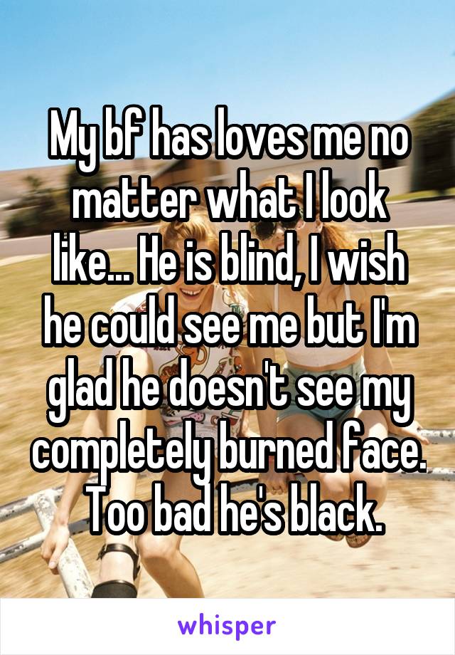 My bf has loves me no matter what I look like... He is blind, I wish he could see me but I'm glad he doesn't see my completely burned face.  Too bad he's black.