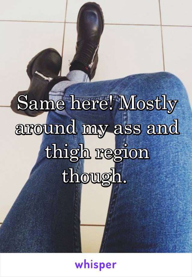 Same here! Mostly around my ass and thigh region though. 