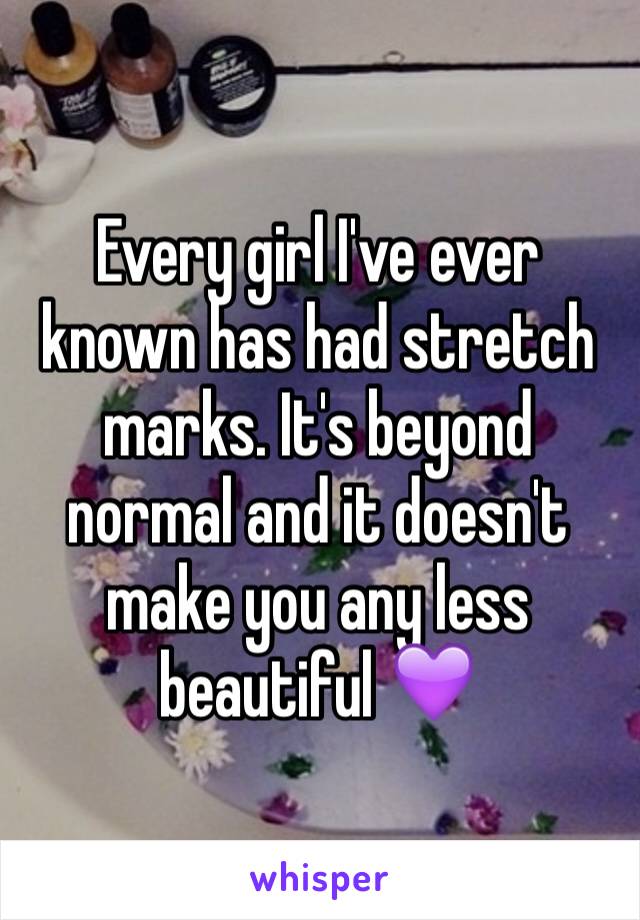 Every girl I've ever known has had stretch marks. It's beyond normal and it doesn't make you any less beautiful 💜