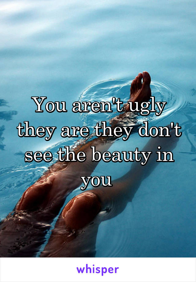 You aren't ugly they are they don't see the beauty in you 