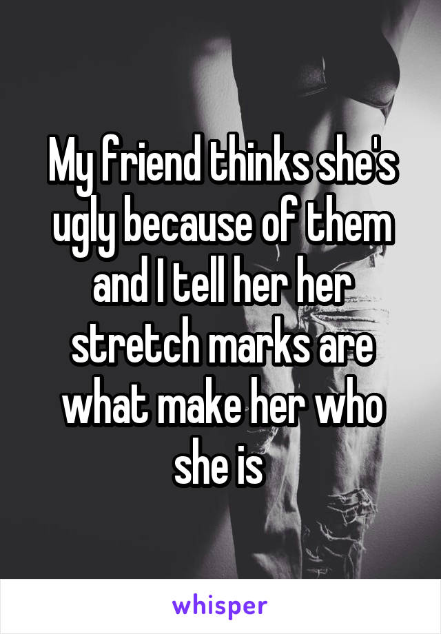 My friend thinks she's ugly because of them and I tell her her stretch marks are what make her who she is 