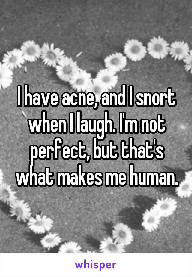 I have acne, and I snort when I laugh. I'm not perfect, but that's what makes me human.