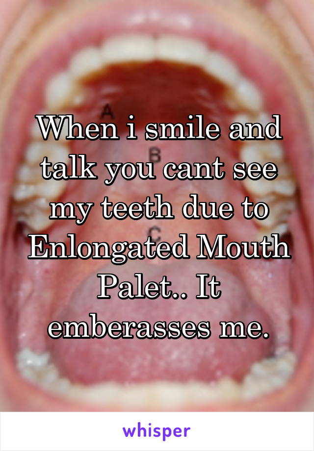 When i smile and talk you cant see my teeth due to Enlongated Mouth Palet.. It emberasses me.