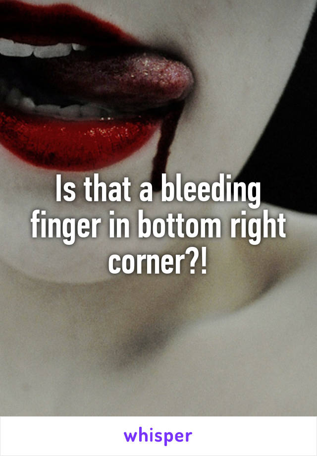Is that a bleeding finger in bottom right corner?!
