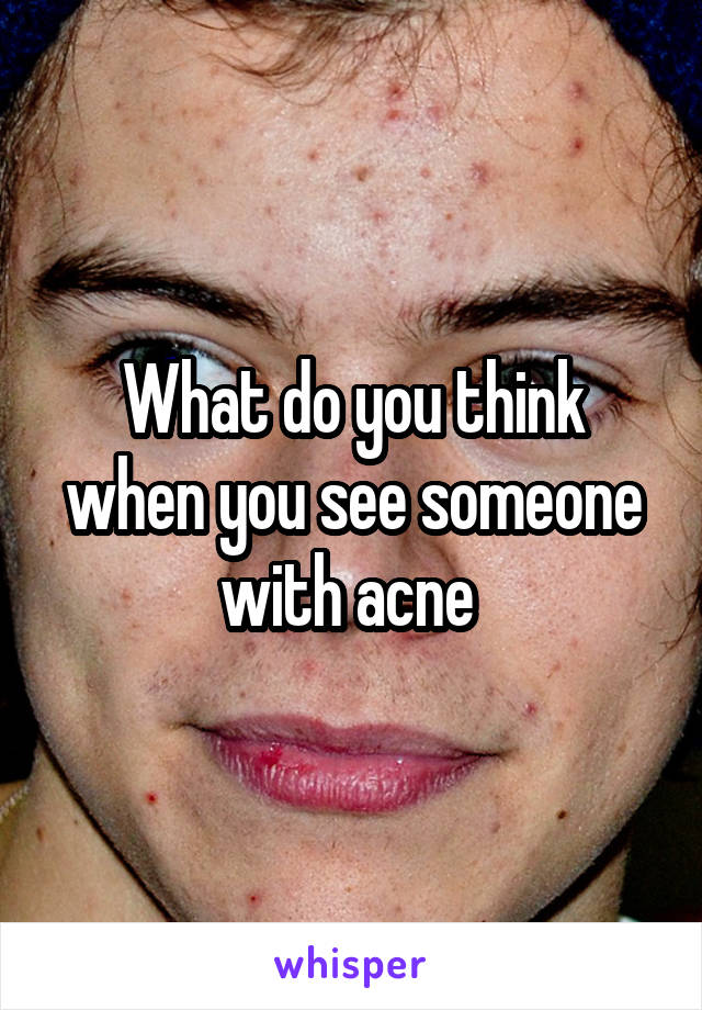 What do you think when you see someone with acne 