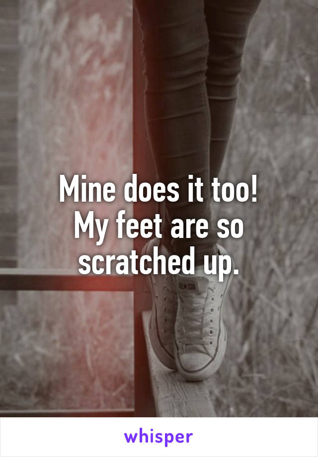 Mine does it too!
My feet are so scratched up.